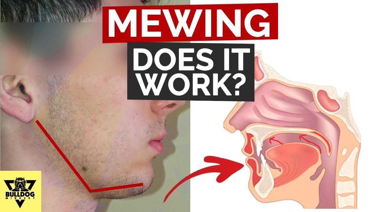 What Is Mewing, Does It Work? (How to Apply It) | Train Your Tongue To Attach To Your Mouth